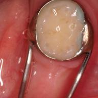 Online Dentist