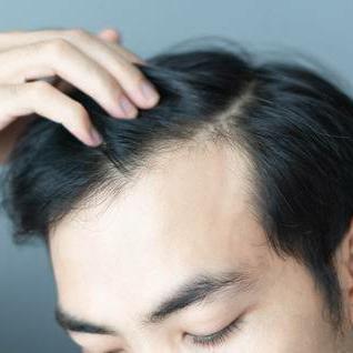 Hair growth PROSPECTS