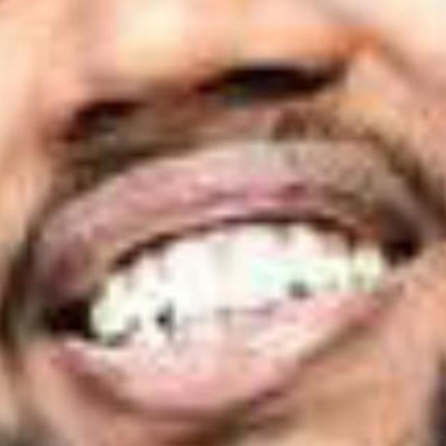 ....